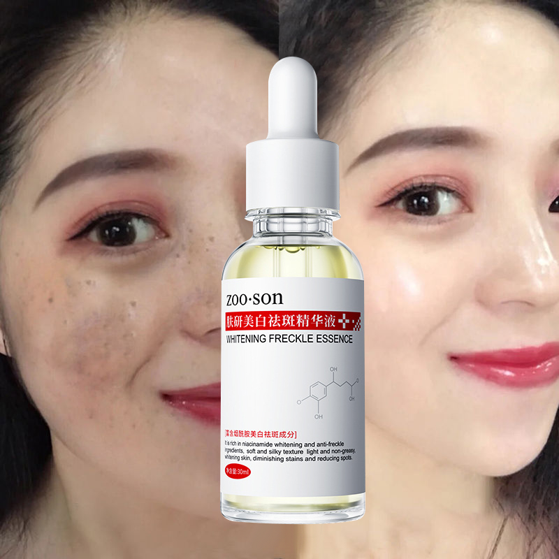 Glowsy ClearSpot Serum